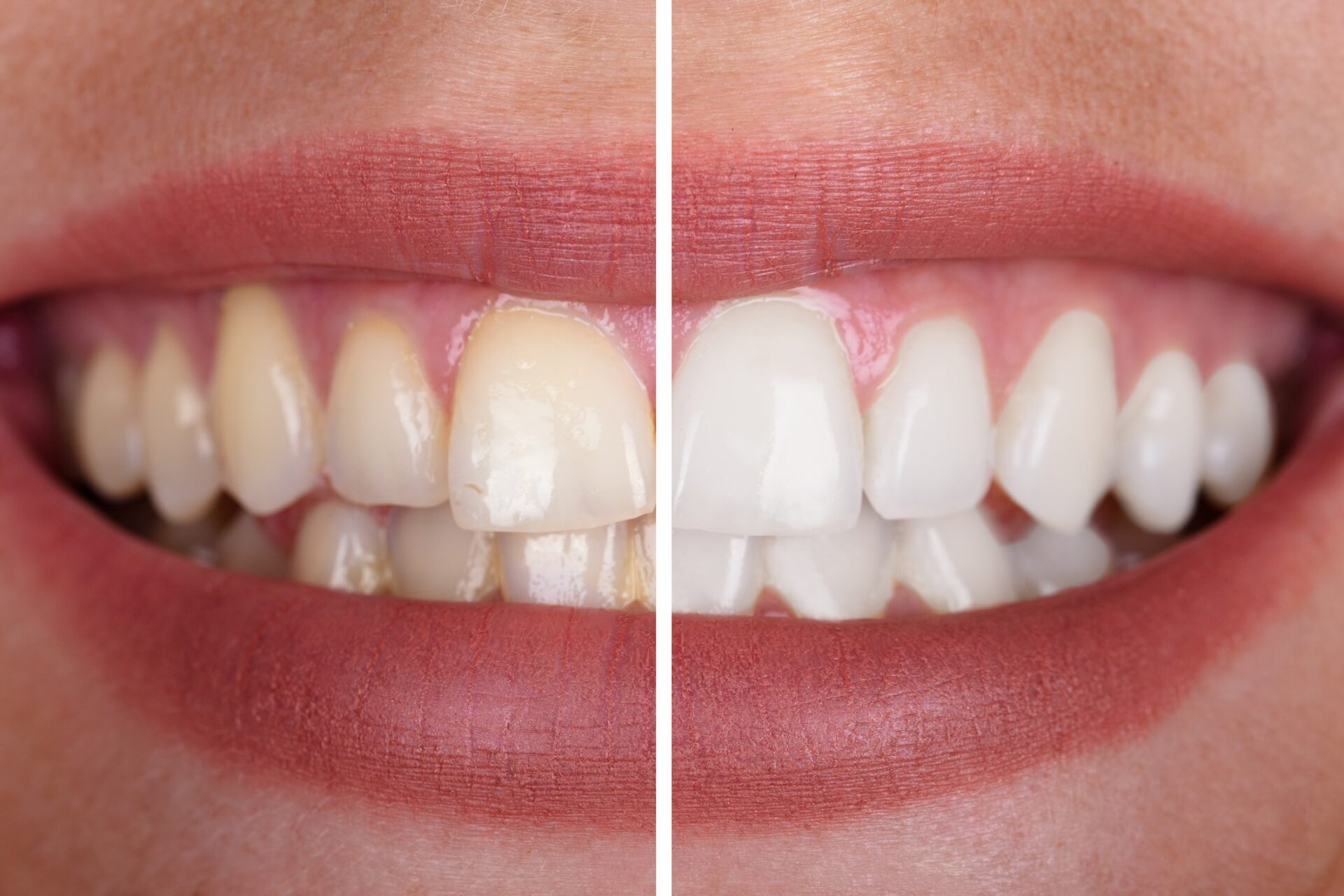 GlorySmile Purple Toothpaste key features and benefits