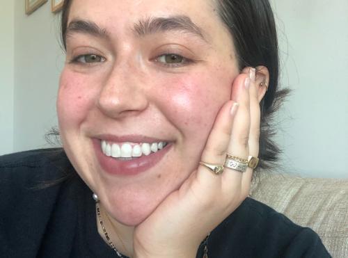Sarah M.'s GlorySmile Purple Toothpaste results